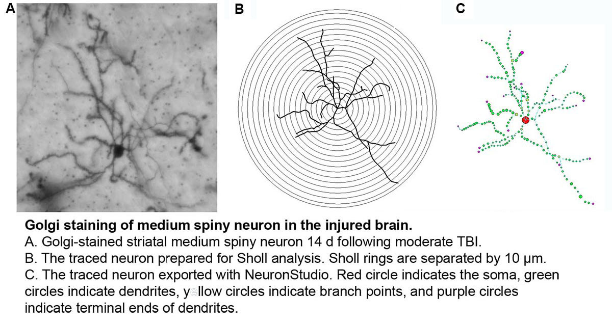 Neuron Tracing